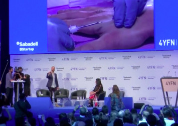 Man receives under-skin chip implant live at mobile show
