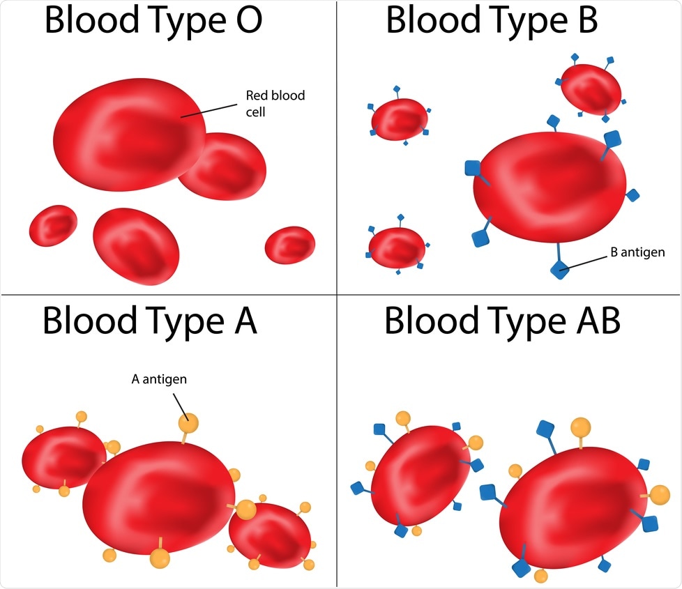 Study: Modelling suggests blood group incompatibility may substantially reduce SARS-CoV-2 transmission. Image Credit: Joshya / Shutterstock